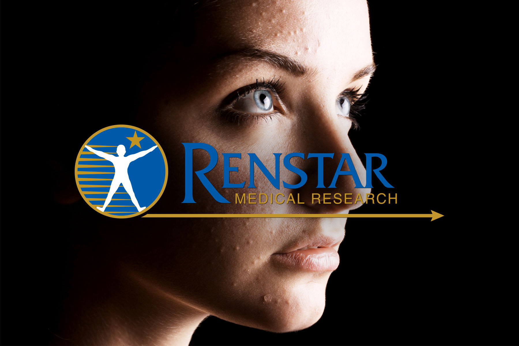 renstar-medical-research-trial-post-acne - Renstar Medical Research